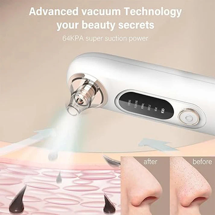 PureLift Pore Extractor