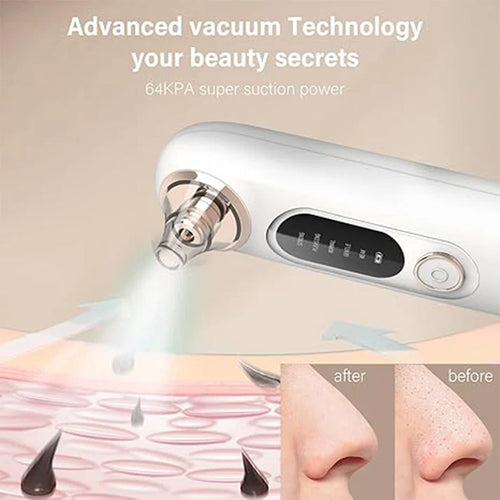 PureLift Pore Extractor